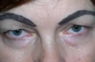 Плохой татуаж бровей